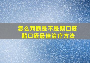 怎么判断是不是鹅口疮 鹅口疮最佳治疗方法